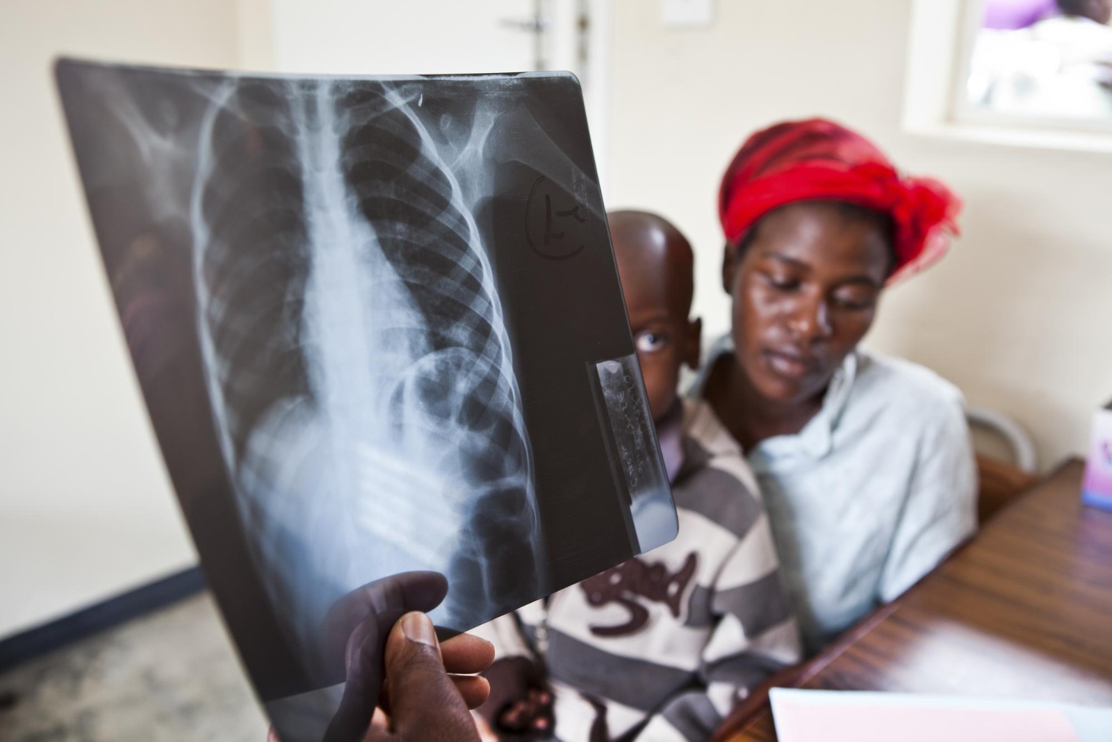 Doctors Without Borders, Tuberculosis